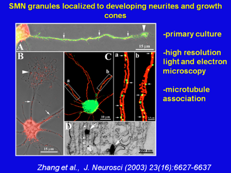 SMN granules